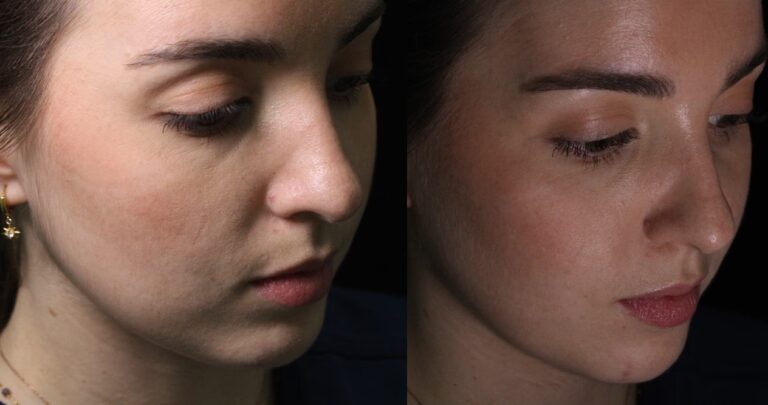 ¿Cuál es la cirugía estética más cara del mundo?