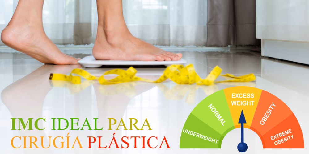¿Cuánto IMC debo tener para operarme?