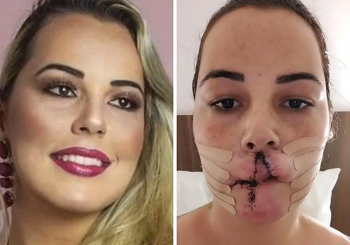¿Pueden las modelos someterse a cirugía estética?