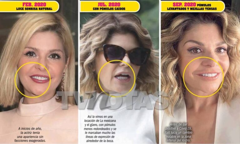 Cirugía Plástica: Entre el Deseo y el Exceso