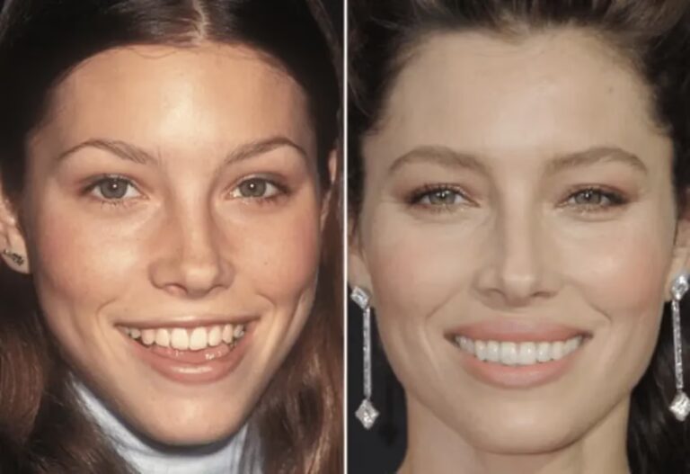 Jessica Biel: ¿Cirugía Plástica o Belleza Natural?