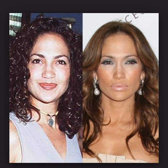 ¿Qué enfermedades padece JLO?