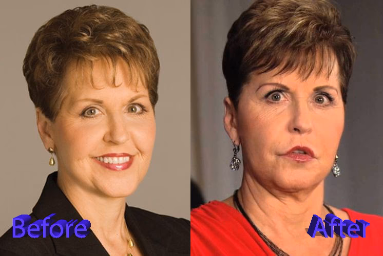 ¿Qué fue lo que pasó con Joyce Meyer?