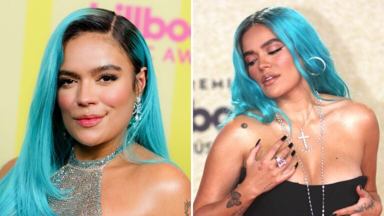 Karol G: ¿Cirugía Plástica o Condición Médica?