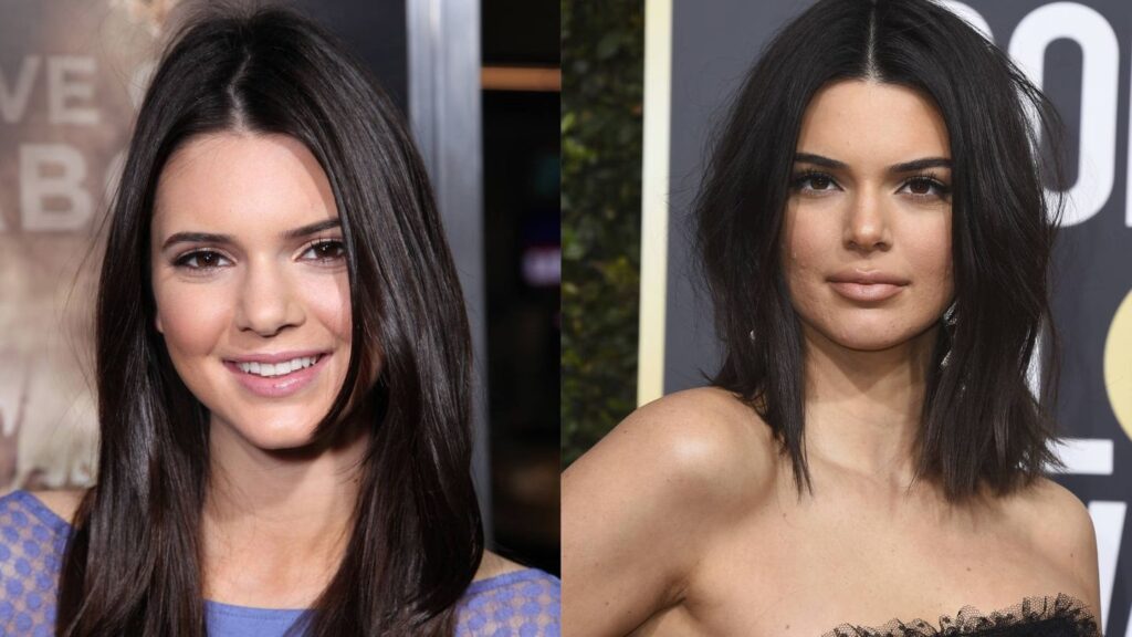 Cirugías Kardashian: La Verdad al Descubierto