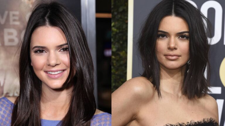 Cirugías Kardashian: La Verdad al Descubierto