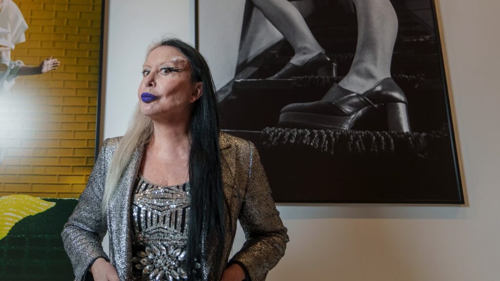 Orlan: El Quirófano como Lienzo de Arte Radical