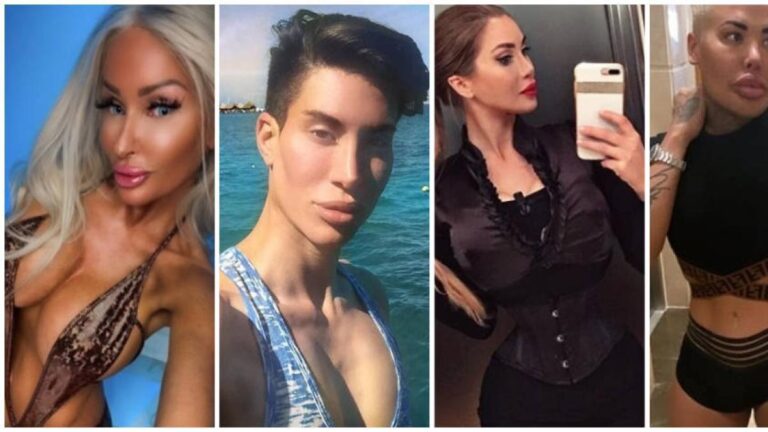 El Récord Mundial de Cirugías Plásticas