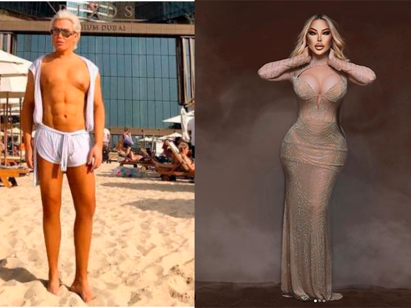 ¿Quién ostenta el récord mundial de mayor número de cirugías plásticas?