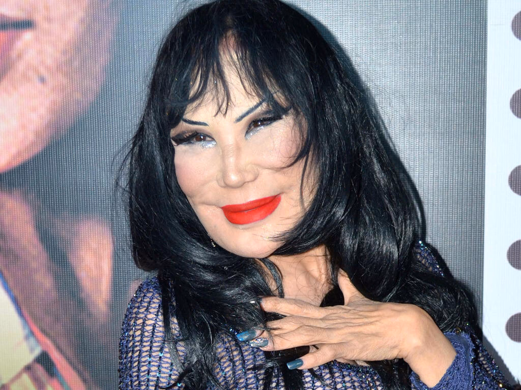 ¿Cuál es la mujer con más operaciones?