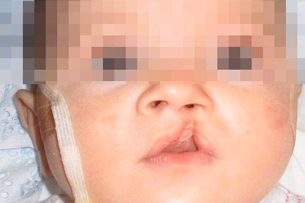 ¿Cuáles son las cirugías menores?