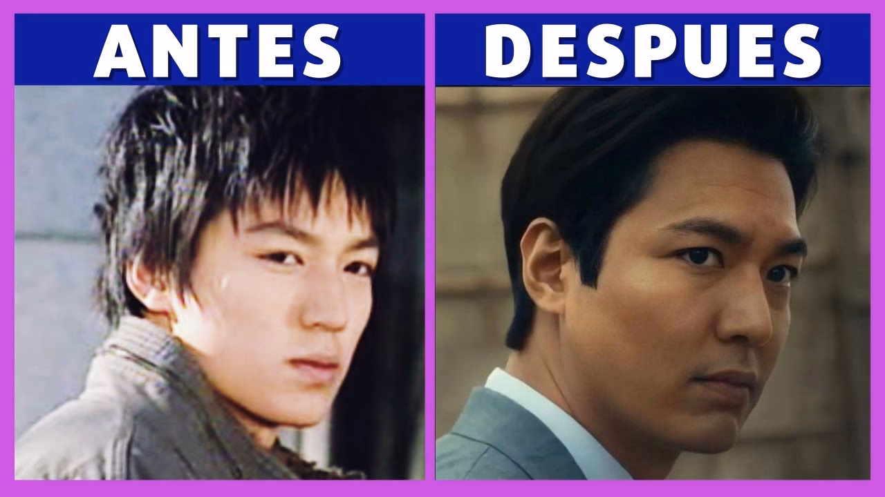 ¿Lalisa se operó la nariz?