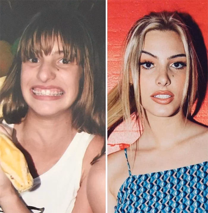 ¿Qué padecimiento tiene Lele Pons?