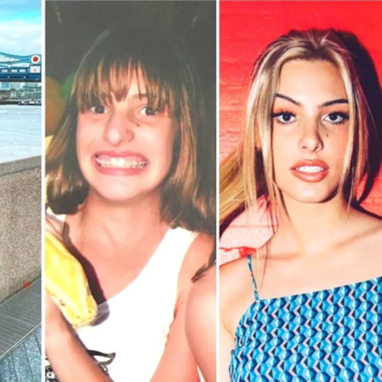 Lele Pons y su Rinoplastia: Toda la Verdad