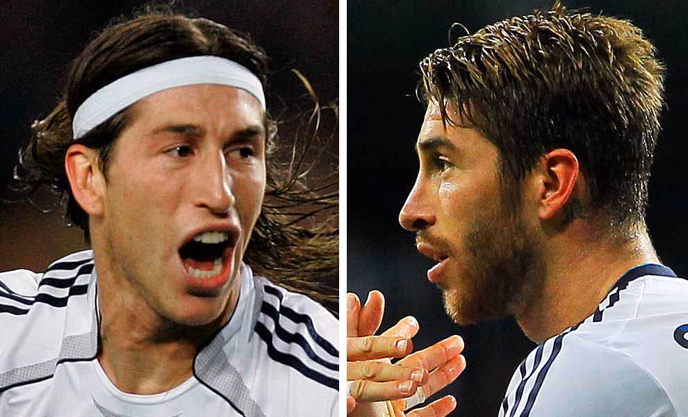 ¿Qué cirugías tiene Sergio Ramos?