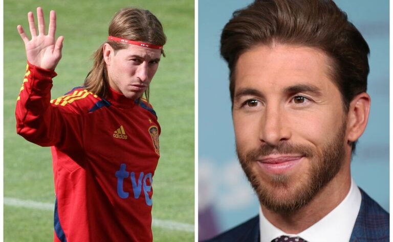 Los Retoques Estéticos de Sergio Ramos al Detalle