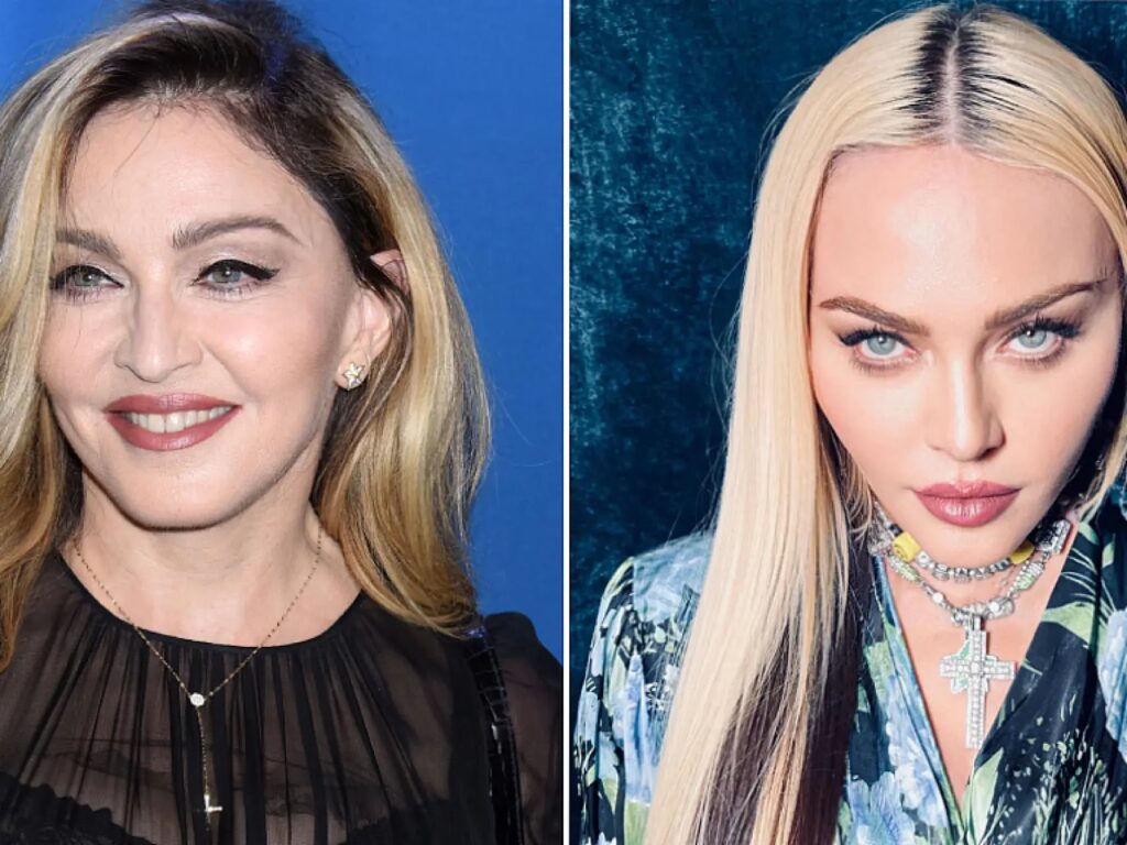 Madonna y el Bisturí: Secretos de su Eterna Juventud