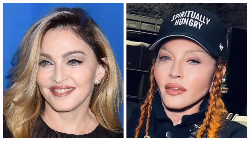 ¿Se ha sometido Madonna a una cirugía de reemplazo de cadera?