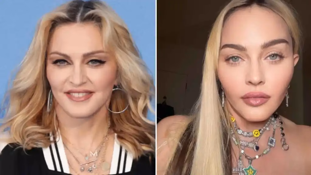 ¿Por qué Madonna se ve tan joven?