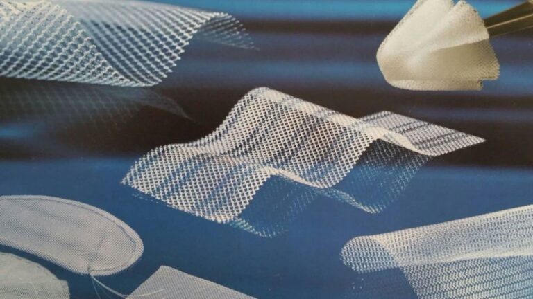 Recuperación de la Malla Abdominal: Tiempos y Cuidados