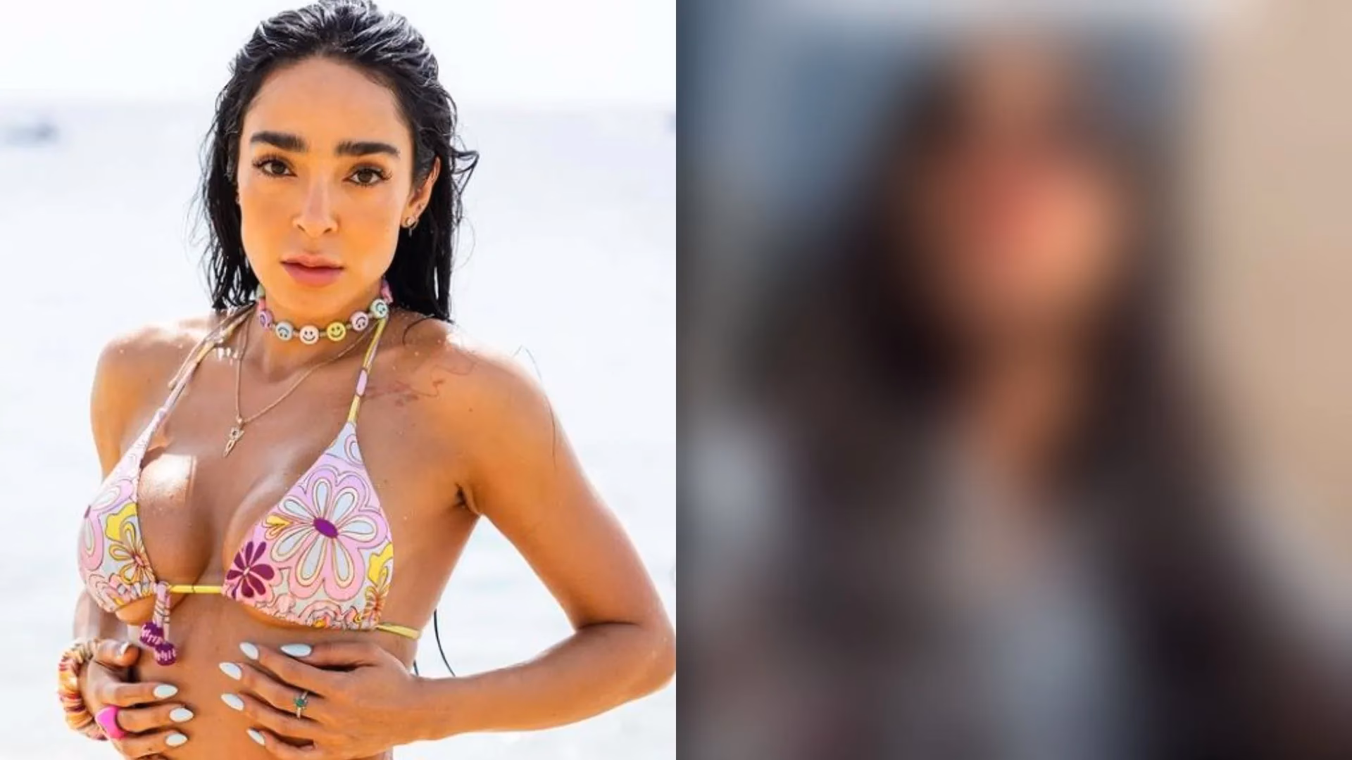 ¿Qué es el mommy makeover sin cirugía?