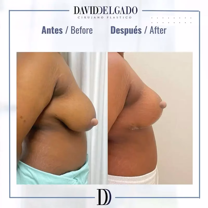 ¿Qué le pasó a Mane en su cara?