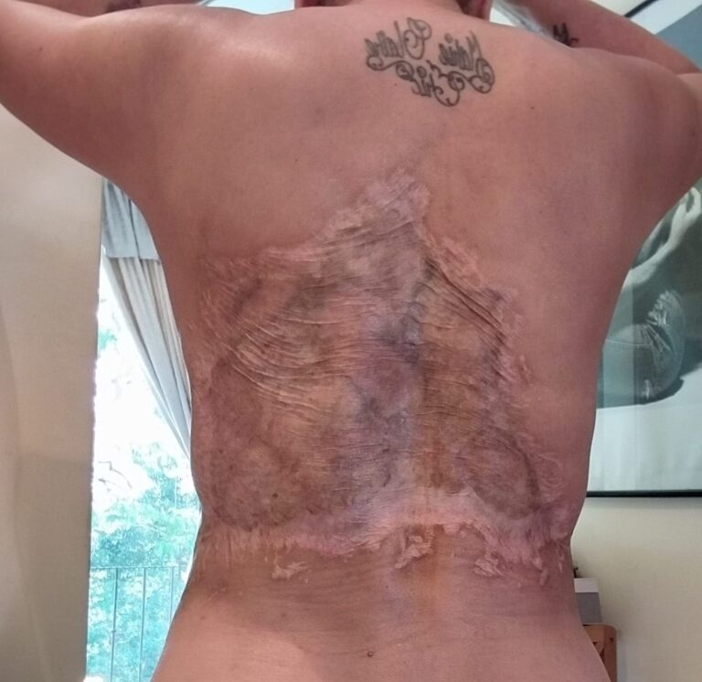 Maricruz Leiva: Juicio por Mala Praxis Estética