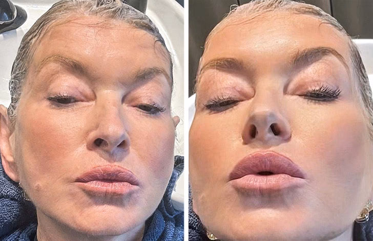 ¿Usa Martha Stewart Sculptra?