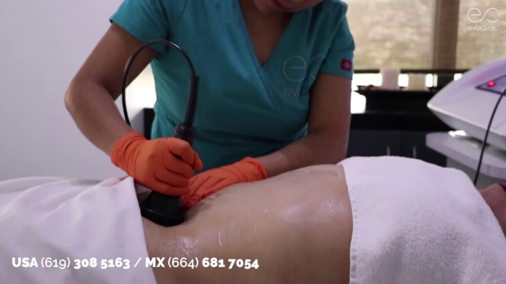 Masajes Postoperatorios: La Clave de tu Recuperación