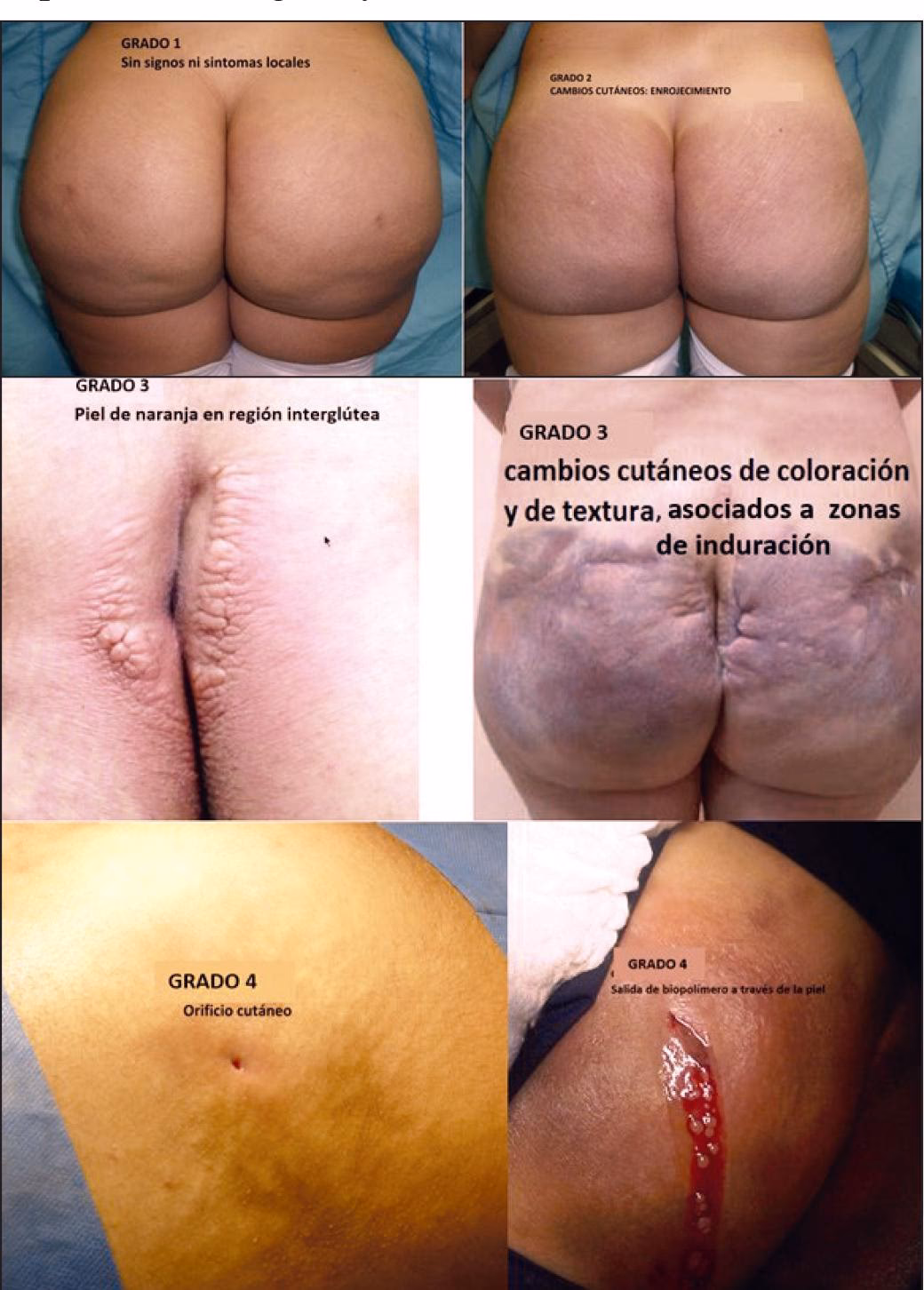 ¿Qué son las sustancias modelantes no autorizadas?