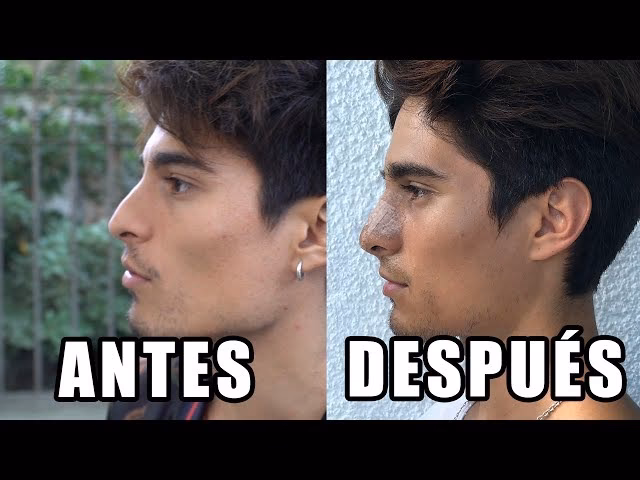 ¿Qué cirugía se hizo la Karen Paola?