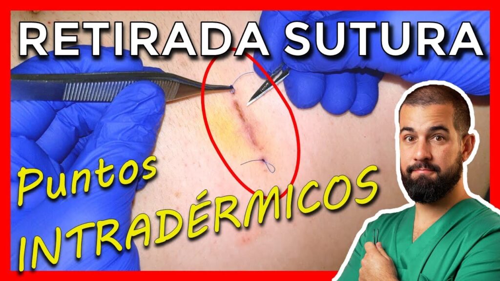 Sutura Rota: Guía de Primeros Pasos y Cuidados