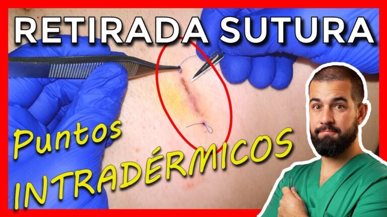 Sutura Rota: Guía de Primeros Pasos y Cuidados