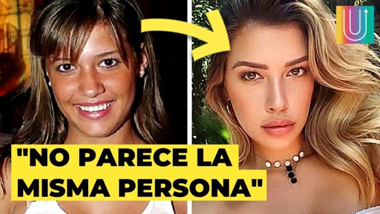 Las cirugías de Michelle Salas: La verdad revelada