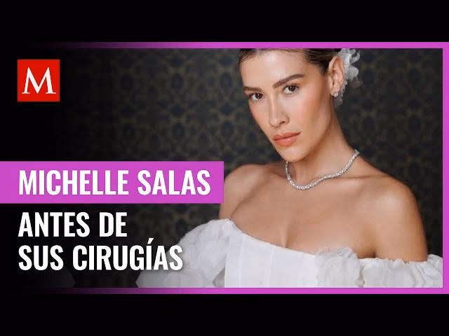 ¿Qué cirugías se hizo Michelle Salas?