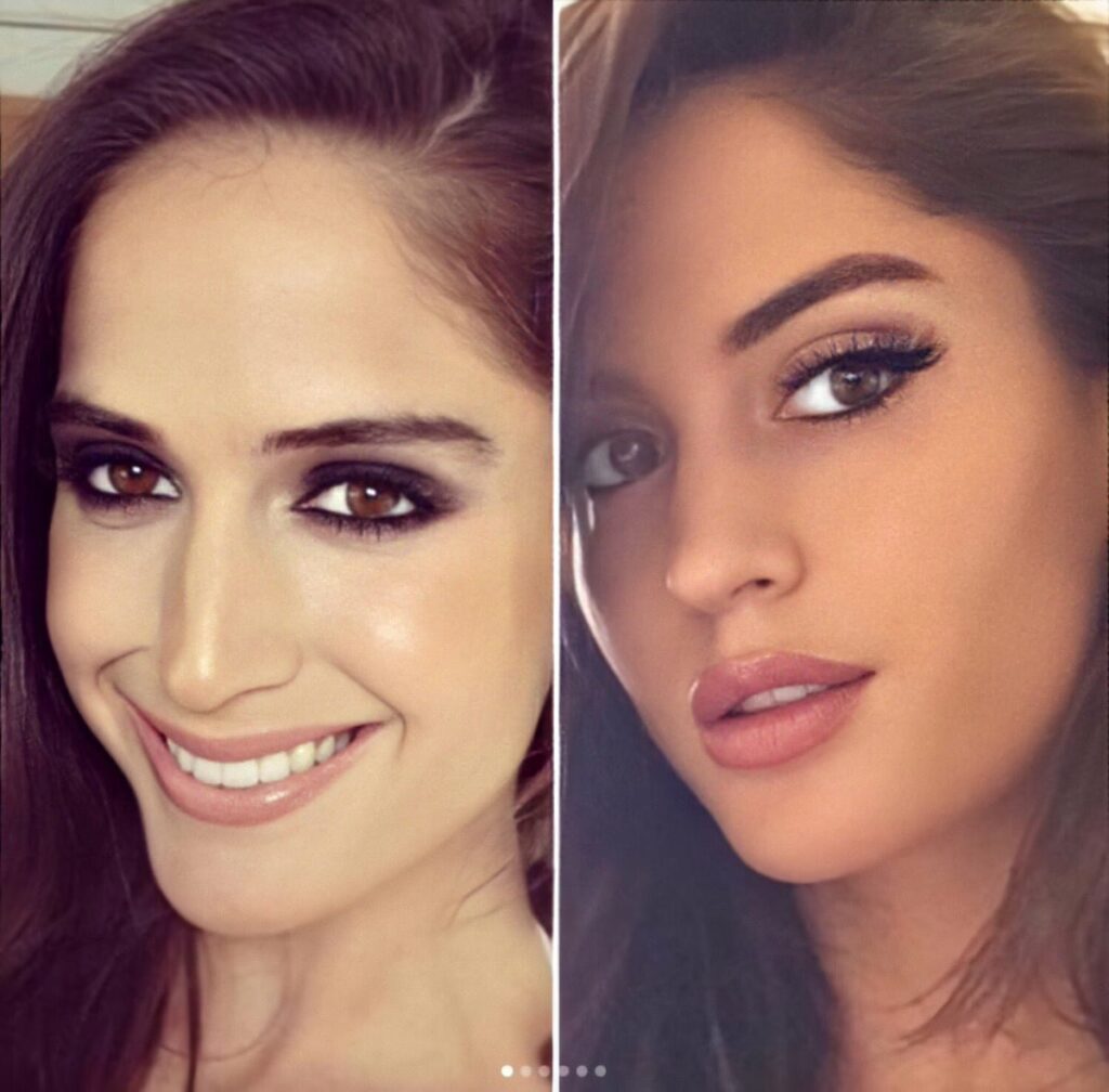 Natalia Rincón: Las cirugías tras el Desafío XX