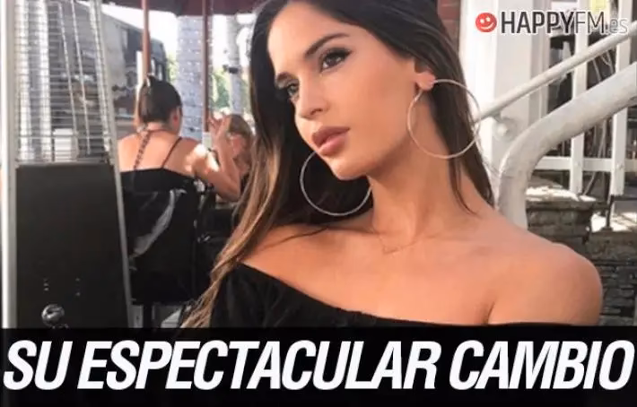 ¿Qué cirugía se hizo Natalia?