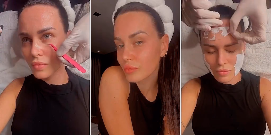 Donatella Versace: El rostro de la transformación