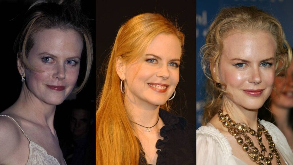 Nicole Kidman: ¿Qué se ha hecho en la cara?