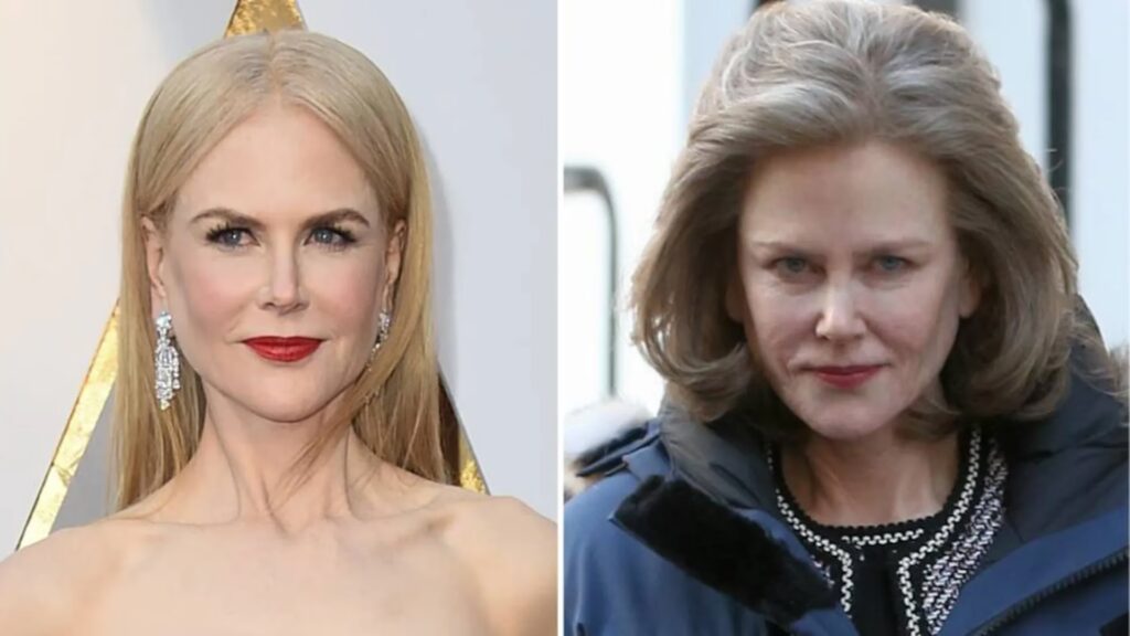Nicole Kidman: ¿Cirugías o Envejecimiento Natural?