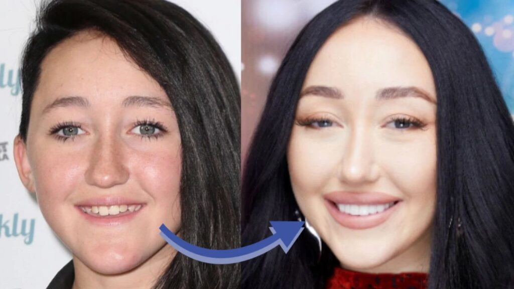 La Transformación Facial de Noah Cyrus