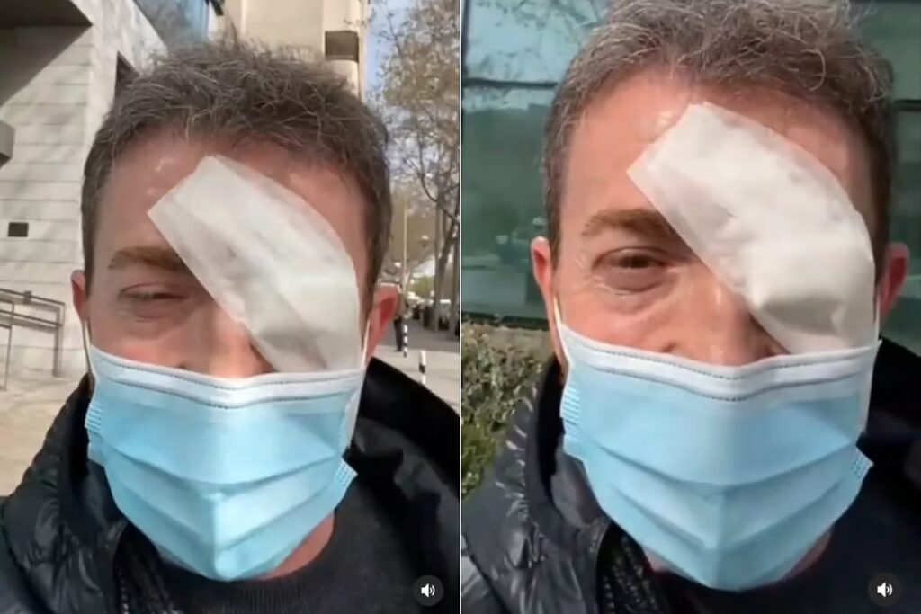 Pablo Motos: Cirugías, Bótox y Retoques Polémicos