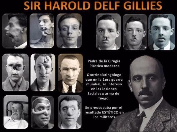 Harold Gillies: El Padre de la Cirugía Plástica