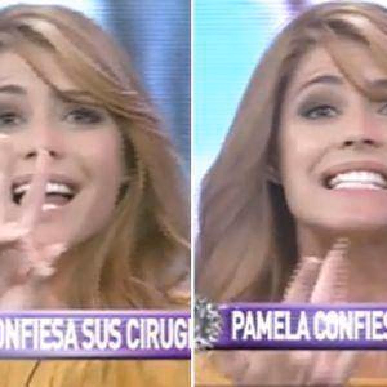 ¿Qué operaciones se ha hecho Pamela Díaz?