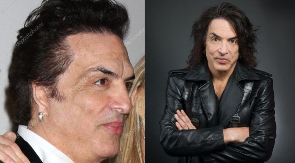 Paul Stanley: Las Cirugías Detrás del Starchild