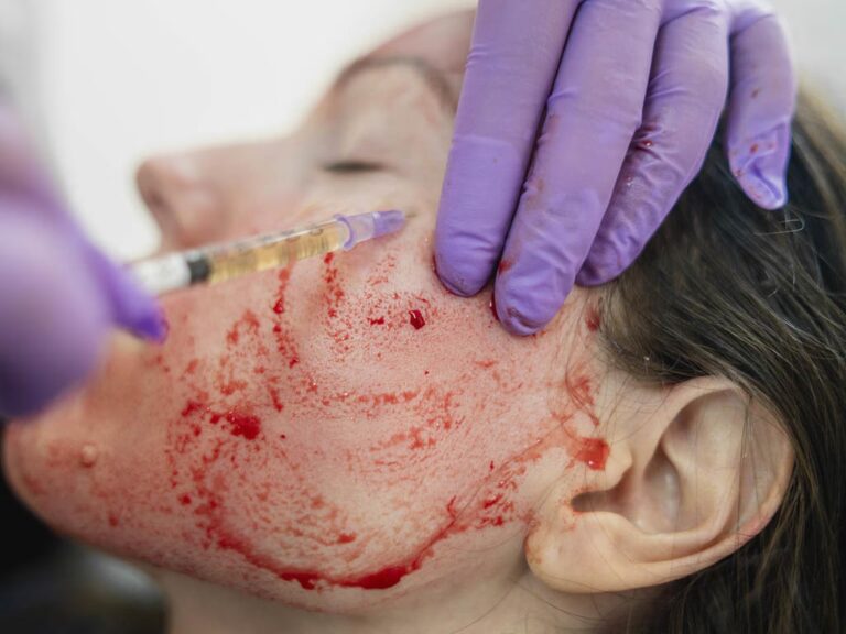 VIH y Cirugía Plástica: Mitos y Realidades