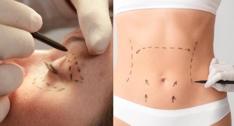 Dr. Araya: Cirujano Plástico de Élite en Costa Rica