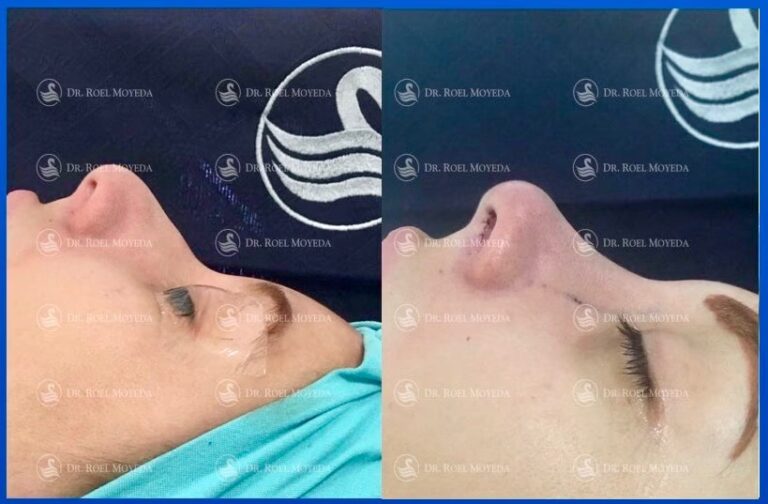 El Mejor Cirujano Plástico de Monterrey: Una Guía