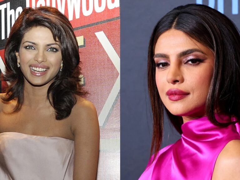 Priyanka Chopra: Cirugía, Maternidad y Resiliencia