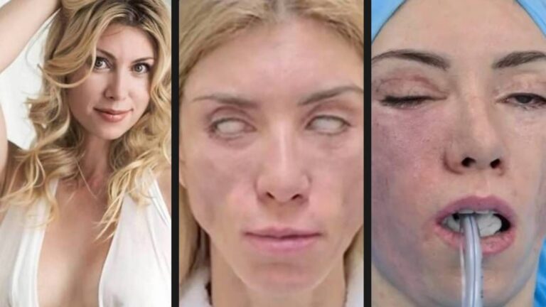 Cirugía Plástica: ¿Conoces los Riesgos Reales?